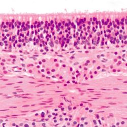 Choose the false statement about the olfactory epithelium